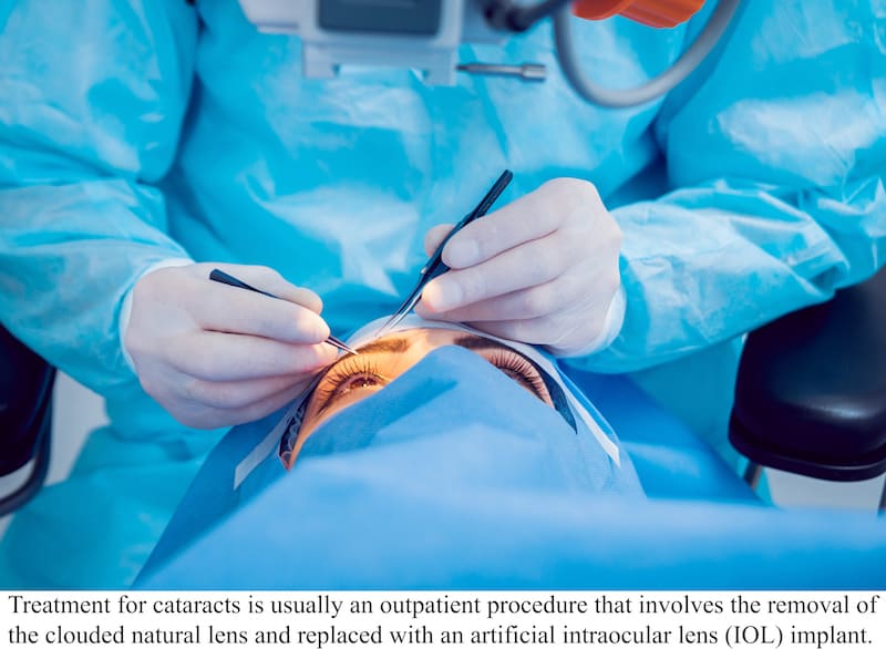 Modern Medicine: Curing a lifetime of Poor Vision 1 Cataract Surgery wcap copy