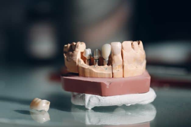 The Most Common Dental Procedures To Fix Your Teeth